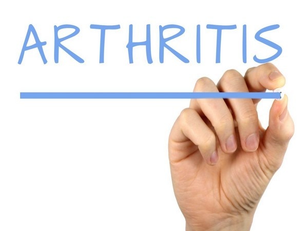 This new technique could improve arthritis treatment This new technique could improve arthritis treatment