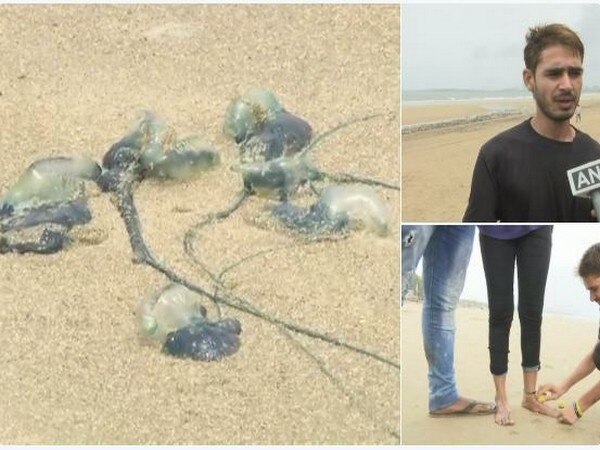 Blue bottle jellyfishes injure many at Mumbai beaches Blue bottle jellyfishes injure many at Mumbai beaches