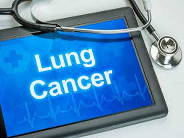 Lung cancer: Stages and treatment options Lung cancer: Stages and treatment options