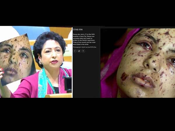 Pakistan envoy Lodhi passes off Palestinian victim as a Kashmiri Pakistan envoy Lodhi passes off Palestinian victim as a Kashmiri