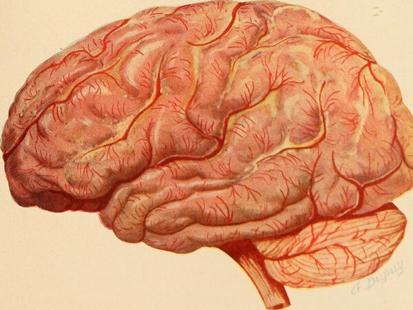 Simple test could help doctors diagnose degenerative brain diseases Simple test could help doctors diagnose degenerative brain diseases