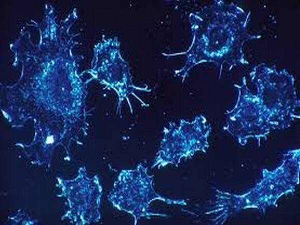 Study finds method to detect cancer in diabetic patients Study finds method to detect cancer in diabetic patients