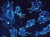 Cancer drug may protect against certain lung ailments