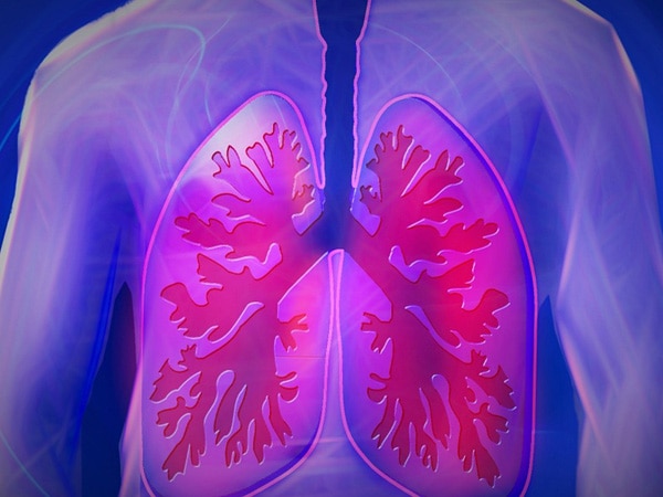Busting myths about COPD Busting myths about COPD