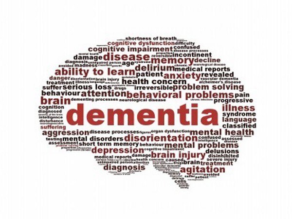 Risk of dementia higher in people with congenital heart disease Risk of dementia higher in people with congenital heart disease