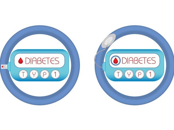 Type 1 diabetes may shorten women's lives by 18 years Type 1 diabetes may shorten women's lives by 18 years