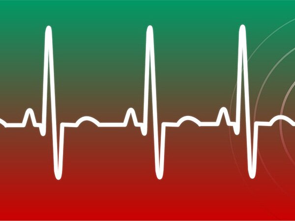 Irregular heartbeat associated with thyroid problems Irregular heartbeat associated with thyroid problems