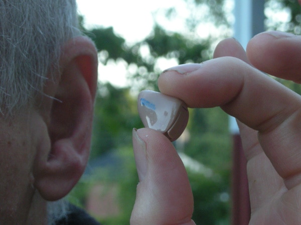 Hearing loss in old-age ups risk of dementia Hearing loss in old-age ups risk of dementia