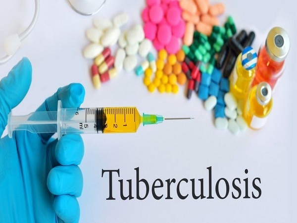 World TB Day - 5 facts about tuberculosis World TB Day - 5 facts about tuberculosis