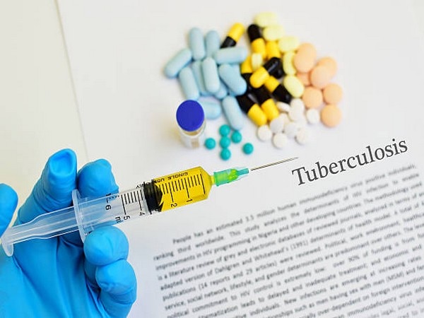 One in ten Indian females affected by TB related ailment One in ten Indian females affected by TB related ailment