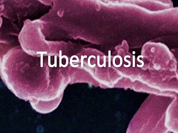 World Tuberculosis Day: Know all about the disease World Tuberculosis Day: Know all about the disease