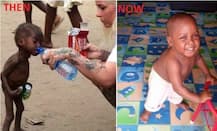 ‘Witch Child’ who was left to die makes stunning recovery