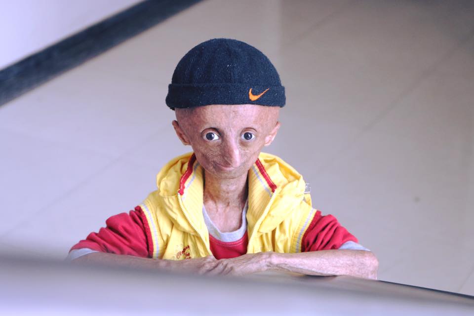 Nihal Bitla, the face of Progeria in India, passes away at 15
