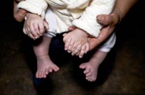 China: Meet Hong Hong, boy born with 31 fingers and toes!