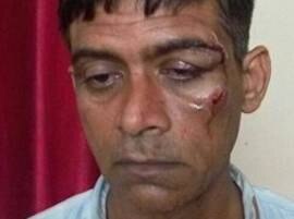 Cabbie assaulted by Africans in Delhi  Cabbie assaulted by Africans in Delhi