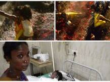 SHOCKING: Father Drops 6-Year-Old Son On Red-Hot Coal During Ritual In Jalandhar