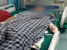 Acid thrown on 24-year-old girl by bike borne assailants in Bhopal