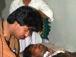 Pakistan man attacked with acid by girlfriend for refusing to marry her