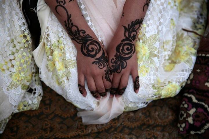 A yemen girl displays her hands. (Source: AP)