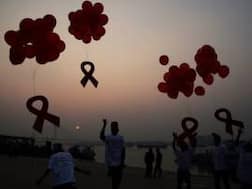 Austrian researchers develop potential AIDS treatment breakthrough