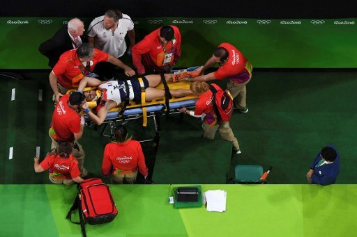 French gymnast's horrific leg break chills gymnastics arena [Graphic Images]