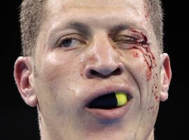 Blood and guts: Olympic boxers dealing with facial cuts  Blood and guts: Olympic boxers dealing with facial cuts