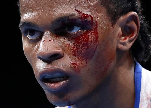 Seychelles' Andrique Allisop watches as he fights Ireland's David Joyce during a men's lightweight 60-kg preliminary boxing match at the 2016 Summer Olympics in Rio de Janeiro, Brazil, Sunday, Aug. 7, 2016. (AP Photo/Frank Franklin II)