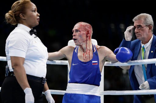 Blood and guts: Olympic boxers dealing with facial cuts