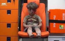 HEARTBREAKING Bloodied Syrian Boy\'s Picture Provokes Global Outrage