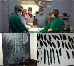 Amritsar: Policeman eats 40 knives, says spiritual powers made him do it