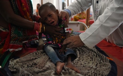 Exclusive: Number of severely malnourished children increased by 700 % in Delhi Exclusive: Number of severely malnourished children increased by 700 % in Delhi