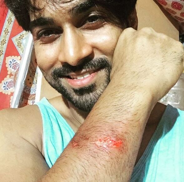 Salman Yusuff Khan INJURED on the sets of 'Jhalak' Salman Yusuff Khan INJURED on the sets of 'Jhalak'