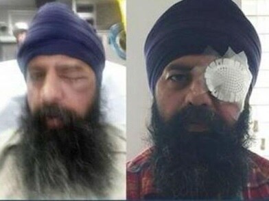 Sikh-American brutally assaulted in alleged hate crime in US Sikh-American brutally assaulted in alleged hate crime in US