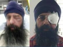 Sikh-American brutally assaulted in alleged hate crime in US