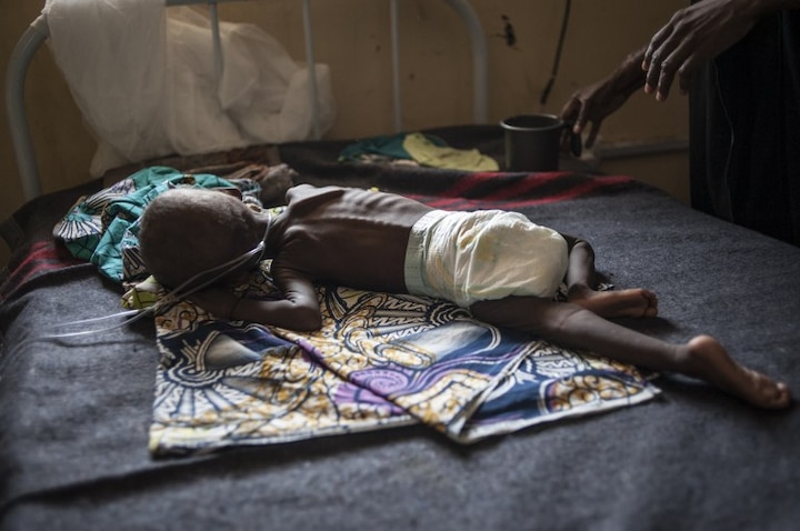 80,000 children will starve to death in Nigeria if not treated in crisis by Boko Haram, says UNICEF 80,000 children will starve to death in Nigeria if not treated in crisis by Boko Haram, says UNICEF