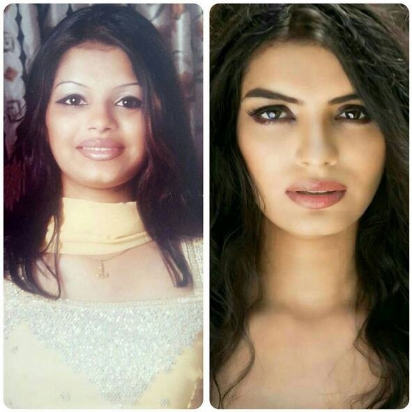 This photo is unbelievable and it shows her journey from being fat to fit. Well, truly the girl on left is unmatchable but we do agree with Sonali’s caption, “#TuesdayTransformation This is my journey from fat to fit. But in the end its all about loving yourself. #LoveYourself #FatToFit”