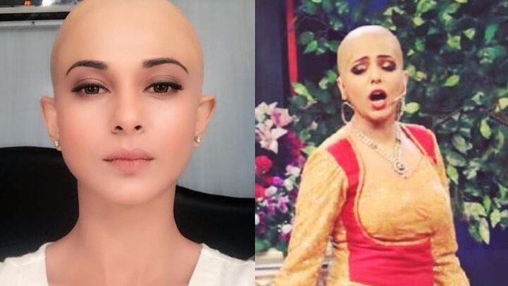 After Jennifer Winget, Sugandha Mishra goes BALD After Jennifer Winget, Sugandha Mishra goes BALD