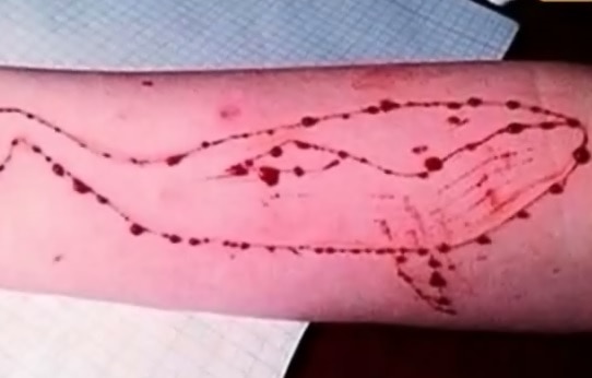 Viral Sach: 'Blue Whale Challenge' enslaves teenagers, tricks them into committing suicide? Viral Sach: 'Blue Whale Challenge' enslaves teenagers, tricks them into committing suicide?