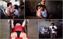 This 10-month-old weighs 28kg; Mother says she thought growth is because of \'good breast milk\'