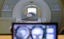 BMC to probe man\'s death after getting sucked in MRI machine