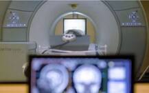 MRI machine death case: Radiologist of Nair hospital arrested