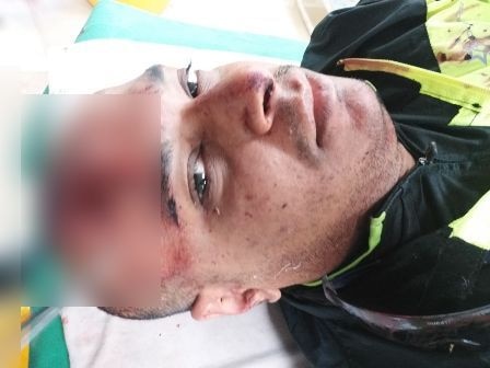 Cyclists in Ambala get beaten and robbed, narrate the horrible ordeal Cyclists in Ambala get beaten and robbed, narrate the horrible ordeal