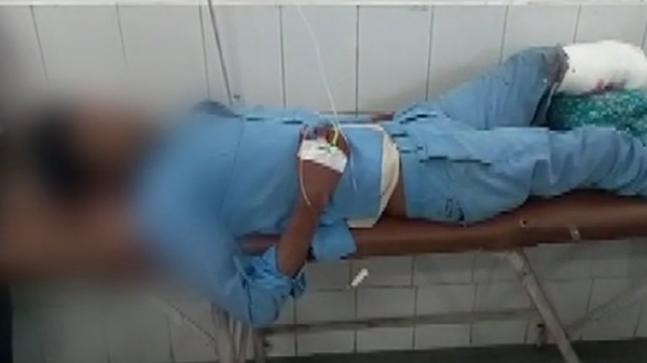 Shocking! Patient’s Amputated Leg Used As pillow In Jhansi Hospital Shocking! Patient's Amputated Leg Used As Pillow In Jhansi Govt Hospital