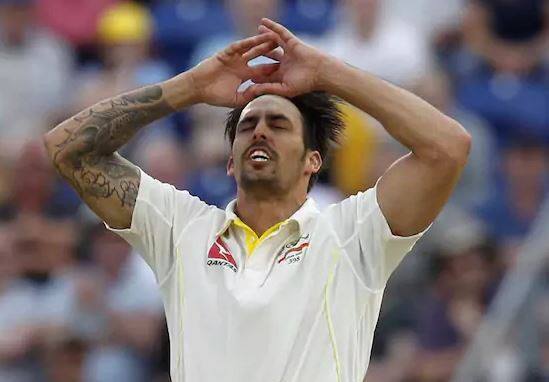 A gym exercise went horribly wrong for Mitchell Johnson, leaving the former Australia fast bowler in a bloody mess.