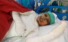 Pakistan: Christian girl dies after being set on fire for refusing marriage proposal