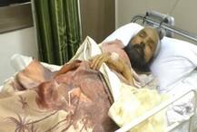 Asian Games gold medalist battling liver, kidney ailments