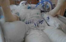 Internet\'s Trending \'Fire Challenge\' Leaves 12-Year-Old Severely Burned In US