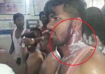 Karnataka: Ten injured in an alleged chemical attack at Congress victory rally