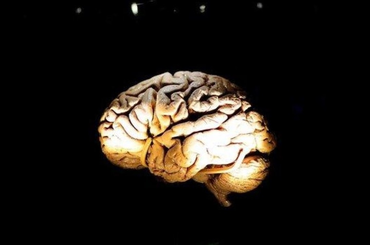 Possible cause for Alzheimer's, traumatic brain injury identified Possible cause for Alzheimer's, traumatic brain injury identified