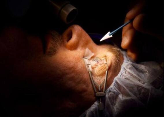 World Sight Day: Cataract management has evolved to refractive surgery